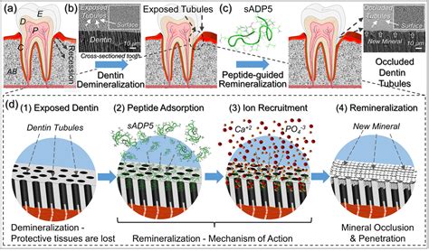  Dentin: Revolutie in Tandheelkunde en Beenderherstel!